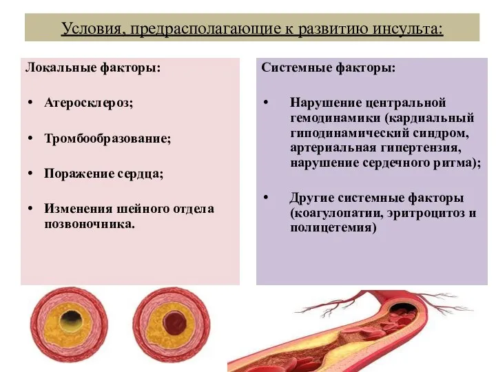 Условия, предрасполагающие к развитию инсульта: Локальные факторы: Атеросклероз; Тромбообразование; Поражение сердца;