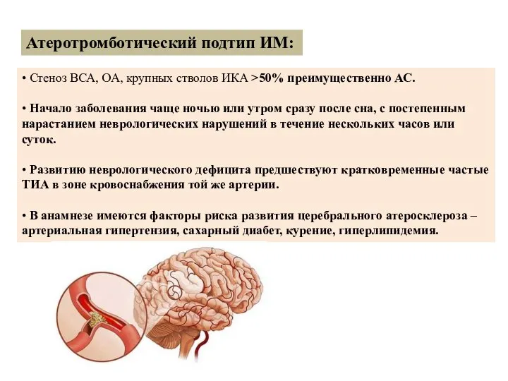 Атеротромботический подтип ИМ: • Стеноз ВСА, ОА, крупных стволов ИКА >50%