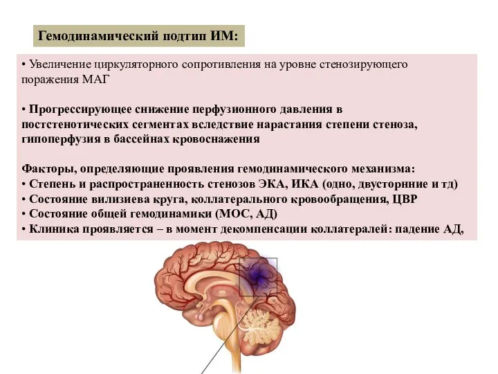 Гемодинамический подтип ИМ: • Увеличение циркуляторного сопротивления на уровне стенозирующего поражения