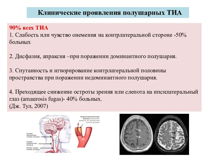 Клинические проявления полушарных ТИА 90% всех ТИА 1. Слабость или чувство