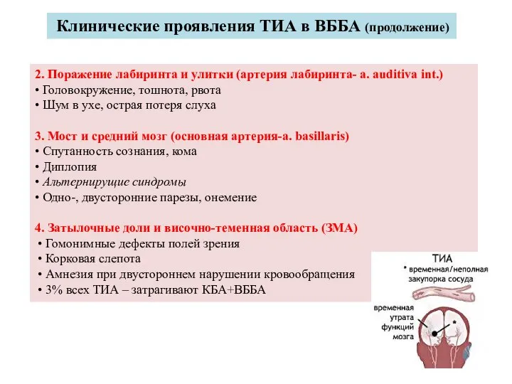 Клинические проявления ТИА в ВББА (продолжение) 2. Поражение лабиринта и улитки