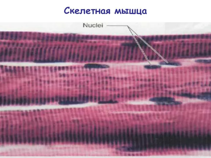 Скелетная мышца