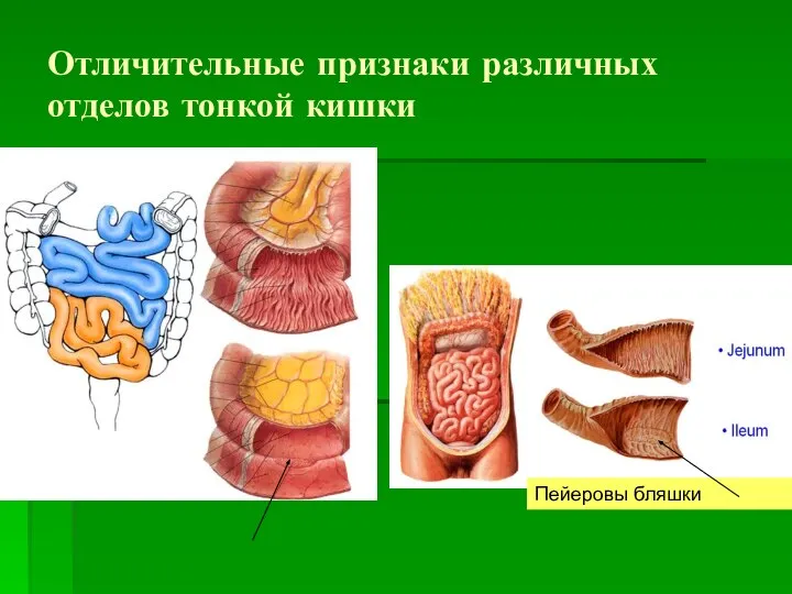 Отличительные признаки различных отделов тонкой кишки Пейеровы бляшки