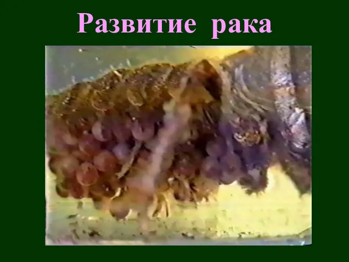 Развитие рака