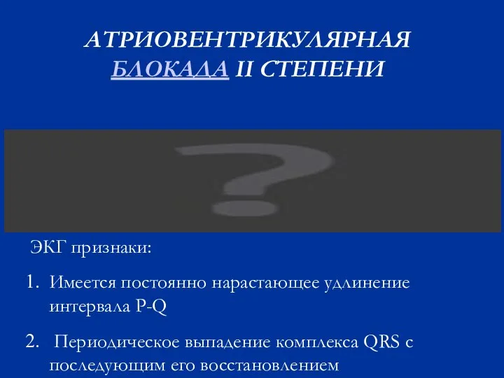 АТРИОВЕНТРИКУЛЯРНАЯ БЛОКАДА II СТЕПЕНИ ЭКГ признаки: Имеется постоянно нарастающее удлинение интервала