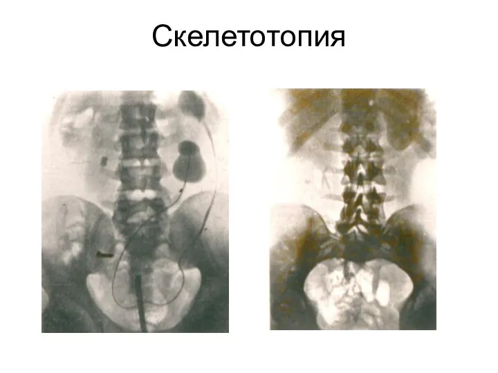 Скелетотопия