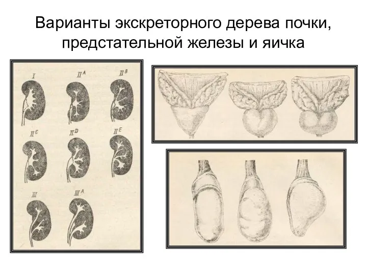 Варианты экскреторного дерева почки, предстательной железы и яичка