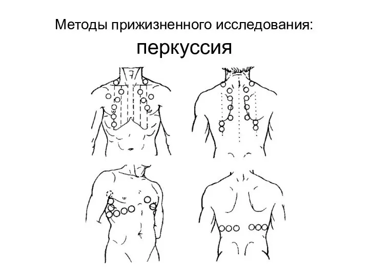 Методы прижизненного исследования: перкуссия