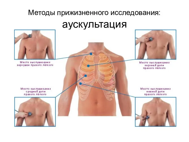 Методы прижизненного исследования: аускультация