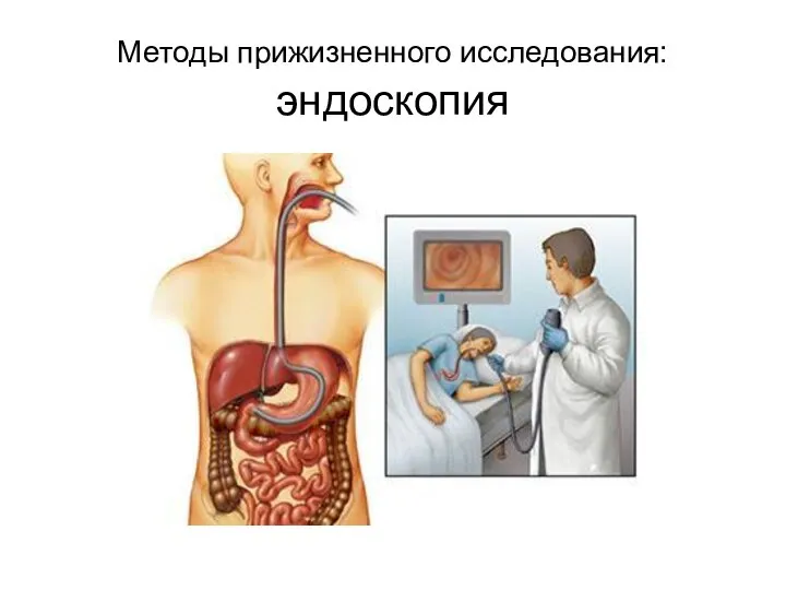 Методы прижизненного исследования: эндоскопия