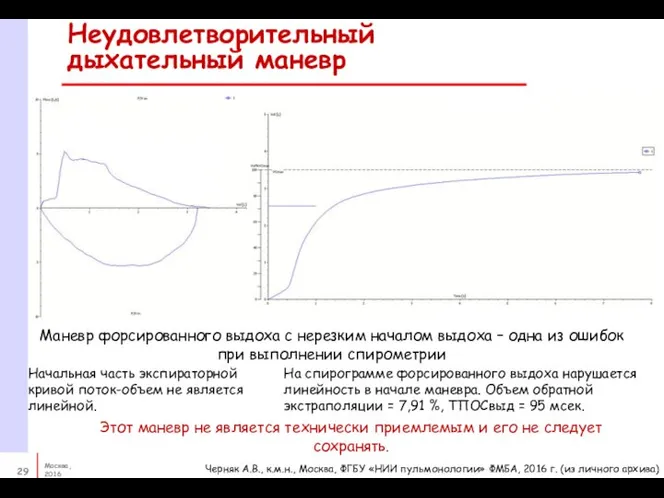 Неудовлетворительный дыхательный маневр Этот маневр не является технически приемлемым и его