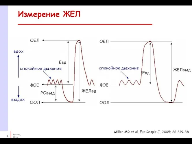 Измерение ЖЕЛ Miller MR et al. Eur Respir J. 2005; 26:319-38