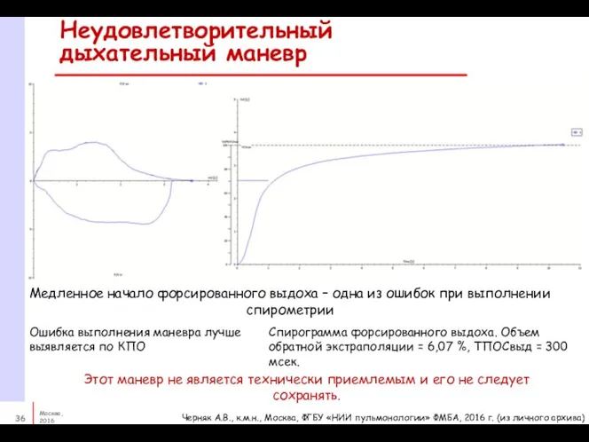 Неудовлетворительный дыхательный маневр Медленное начало форсированного выдоха – одна из ошибок