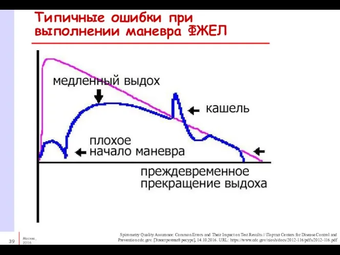 Типичные ошибки при выполнении маневра ФЖЕЛ Spirometry Quality Assurance: Common Errors