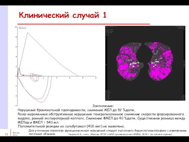 Клинический случай 1 Заключение: Нарушение бронхиальной проходимости, снижение ЖЕЛ до 52