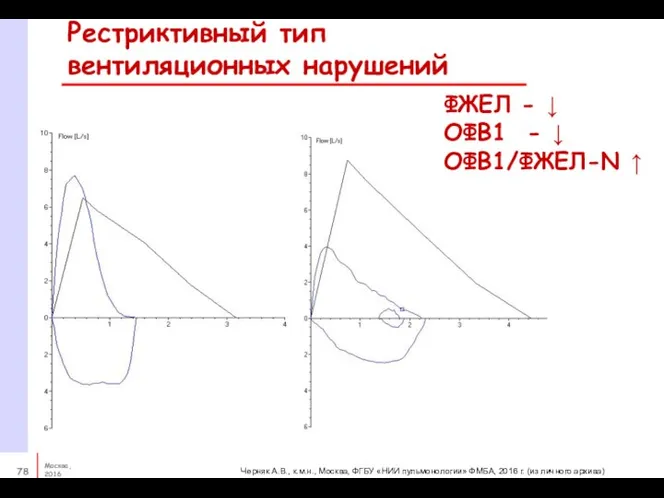 Рестриктивный тип вентиляционных нарушений ФЖЕЛ - ↓ ОФВ1 - ↓ ОФВ1/ФЖЕЛ-N