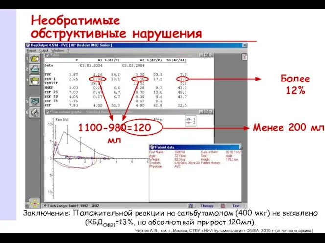 Необратимые обструктивные нарушения Заключение: Положительной реакции на сальбутамолом (400 мкг) не