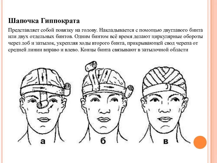 Шапочка Гиппократа Представляет собой повязку на голову. Накладывается с помощью двуглавого