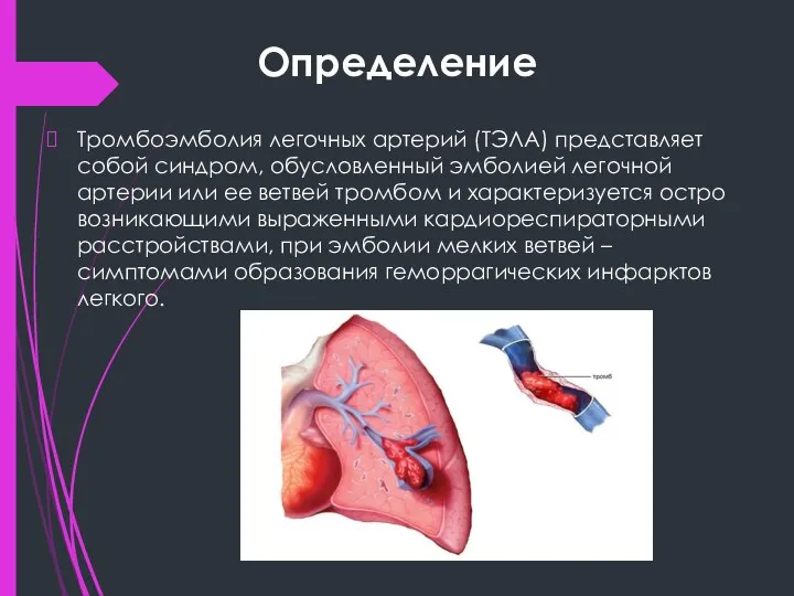 Определение Тромбоэмболия легочных артерий (ТЭЛА) представляет собой синдром, обусловленный эмболией легочной