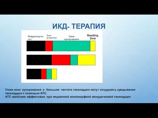 ИКД- ТЕРАПИЯ Рефрактерность Зона ускорения Зона купирования Узкая зона купирования и