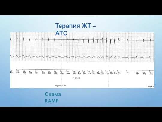 Схема RAMP Терапия ЖТ – АТС