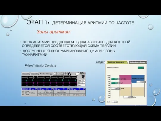 ЭТАП 1: ДЕТЕРМИНАЦИЯ АРИТМИИ ПО ЧАСТОТЕ ЗОНА АРИТМИИ ПРЕДПОЛАГАЕТ ДИАПАЗОН ЧСС,