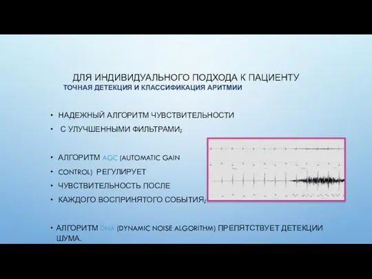 ДЛЯ ИНДИВИДУАЛЬНОГО ПОДХОДА К ПАЦИЕНТУ ТОЧНАЯ ДЕТЕКЦИЯ И КЛАССИФИКАЦИЯ АРИТМИИ НАДЕЖНЫЙ