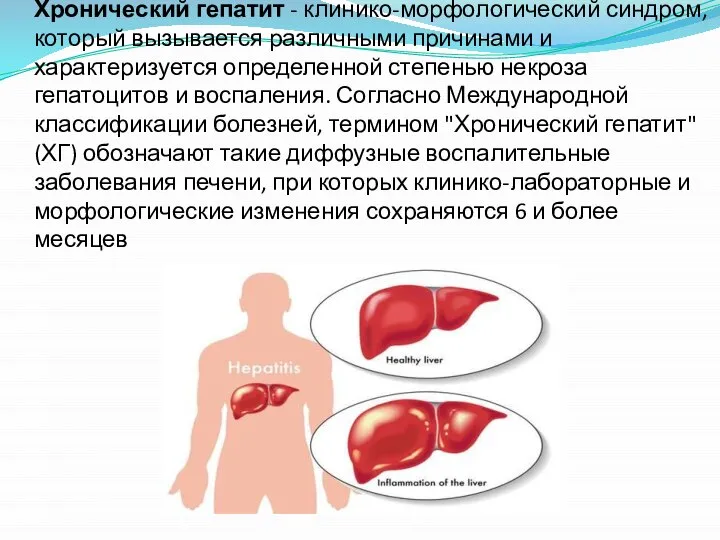 Хронический гепатит - клинико-морфологический синдром, который вызывается различными причинами и характеризуется