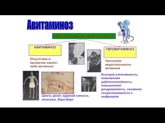 Авитаминоз Виды витаминной недостаточности АВИТАМИНОЗ ГИПОВИТАМИНОЗ Отсутствие в организме какого-либо витамина