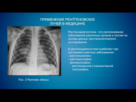 Рентгенодиагностика - это распознавание заболеваний различных органов и систем на основе