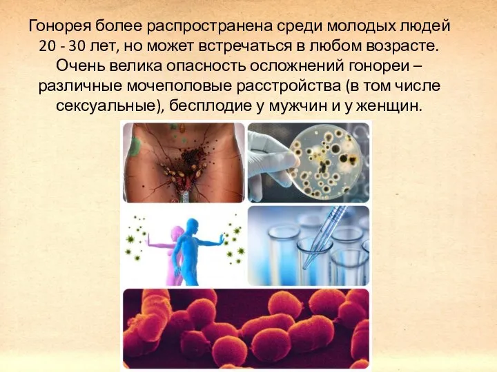 Гонорея более распространена среди молодых людей 20 - 30 лет, но