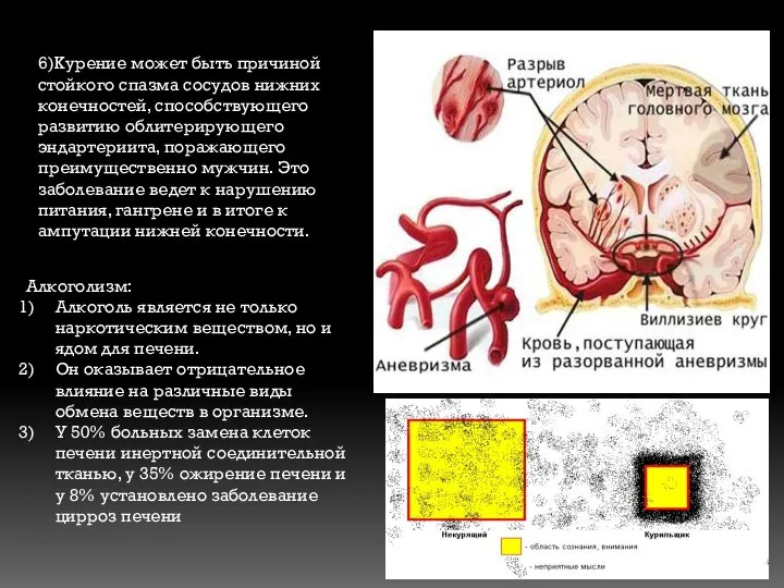 6)Курение может быть причиной стойкого спазма сосудов нижних конечностей, способствующего развитию