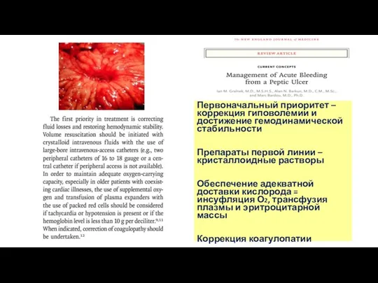 Первоначальный приоритет – коррекция гиповолемии и достижение гемодинамической стабильности Препараты первой