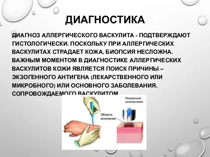 ДИАГНОСТИКА ДИАГНОЗ АЛЛЕРГИЧЕСКОГО ВАСКУЛИТА - ПОДТВЕРЖДАЮТ ГИСТОЛОГИЧЕСКИ. ПОСКОЛЬКУ ПРИ АЛЛЕРГИЧЕСКИХ ВАСКУЛИТАХ