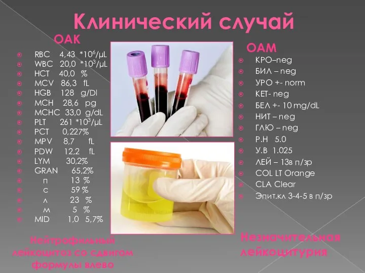 Клинический случай RBC 4,43 *106/µL WBC 20,0 *103/µL HCT 40,0 %