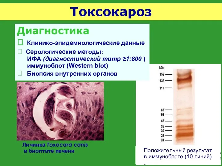 Токсокароз Личинка Toxocara canis в биоптате печени Диагностика  Клинико-эпидемиологические данные