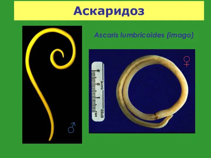 Аскаридоз Ascaris lumbricoides (imago) ♀ ♂