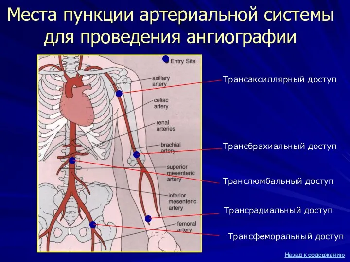 Места пункции артериальной системы для проведения ангиографии ● ● ● ●