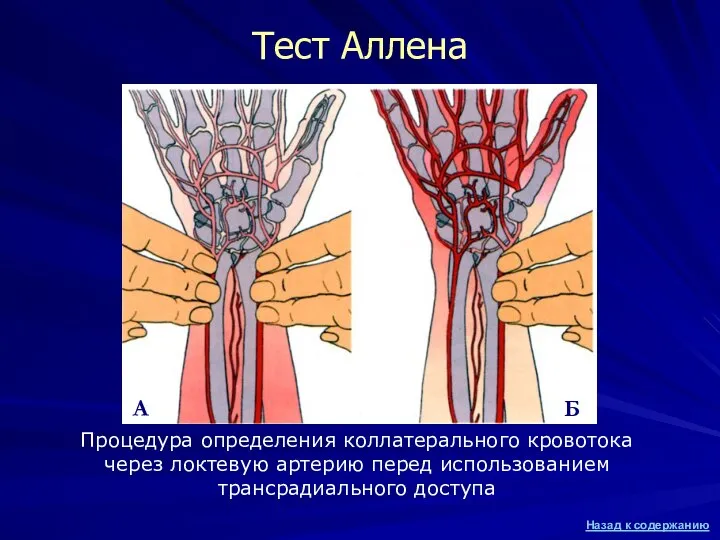 Тест Аллена