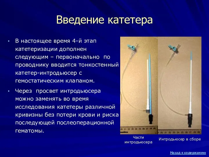 Введение катетера В настоящее время 4-й этап катетеризации дополнен следующим –