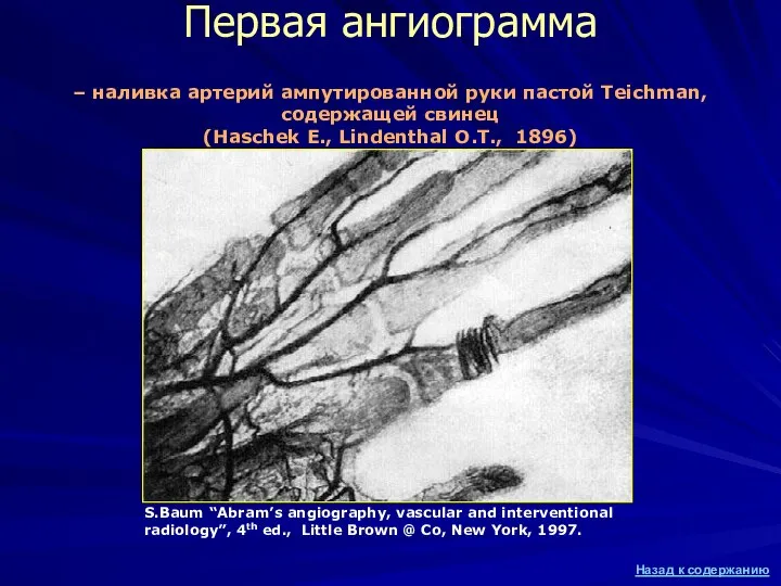 Первая ангиограмма S.Baum “Abram’s angiography, vascular and interventional radiology”, 4th ed.,