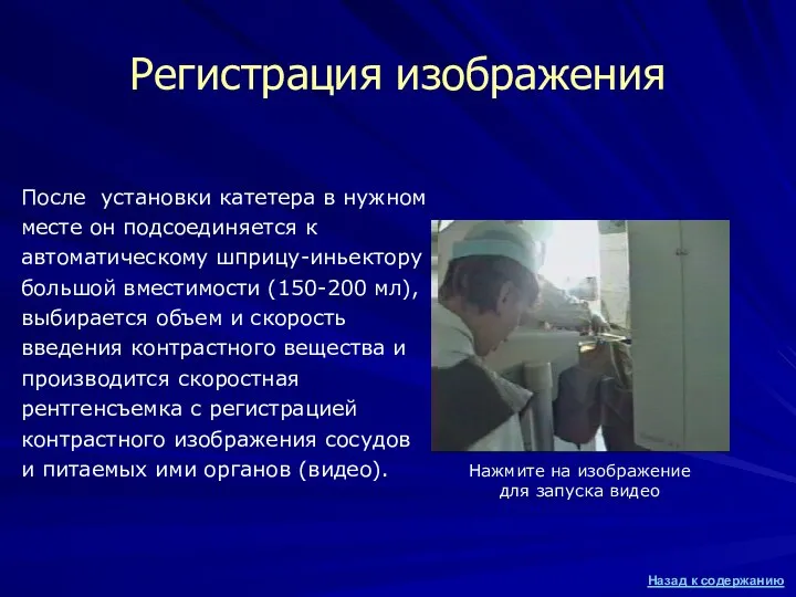 Регистрация изображения После установки катетера в нужном месте он подсоединяется к