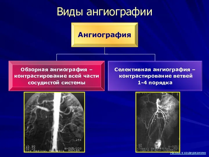 Виды ангиографии