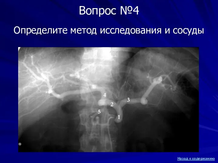 Определите метод исследования и сосуды Вопрос №4