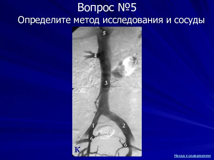 Определите метод исследования и сосуды Вопрос №5