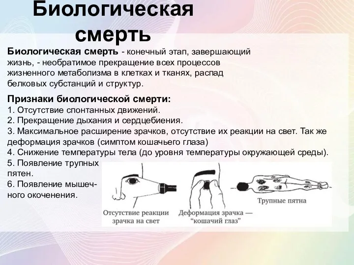 Биологическая смерть