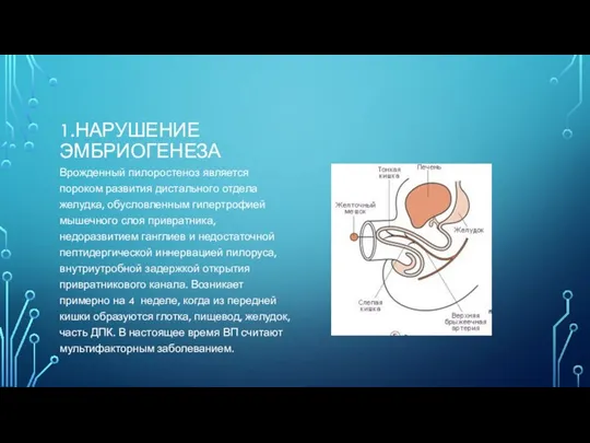 1.НАРУШЕНИЕ ЭМБРИОГЕНЕЗА Врожденный пилоростеноз является пороком развития дистального отдела желудка, обусловленным