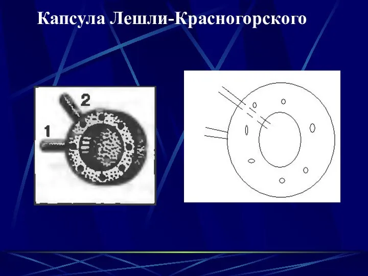 Капсула Лешли-Красногорского