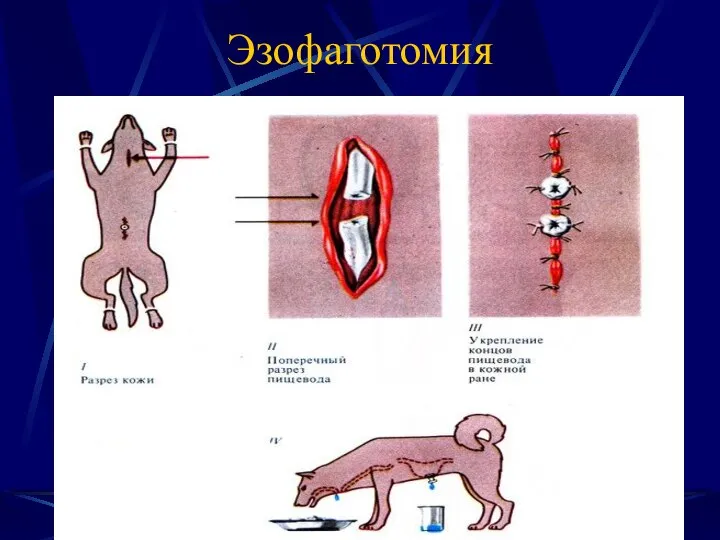 Эзофаготомия