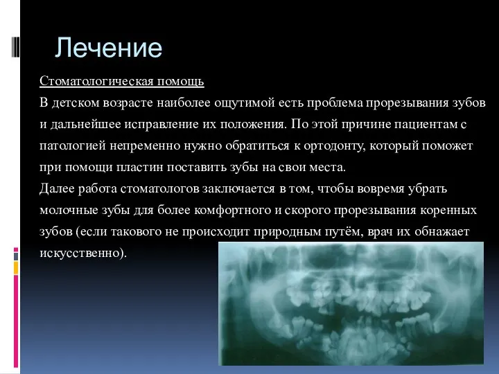 Лечение Стоматологическая помощь В детском возрасте наиболее ощутимой есть проблема прорезывания